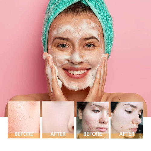 2Pcs Turmeric Facial Cleanser, Turmeric Foaming Face Wash Glow Brightening Face, Deep Cleansing Face Cleanser with Brush (100Ml)